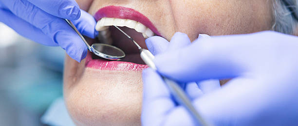 Best Knocked-Out Tooth (Avulsed Tooth) Treatment in Stormstown, PA